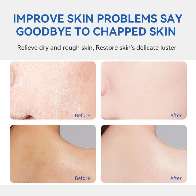 Urea moisturising face cream 150g tub, softens skin and removes dead skin