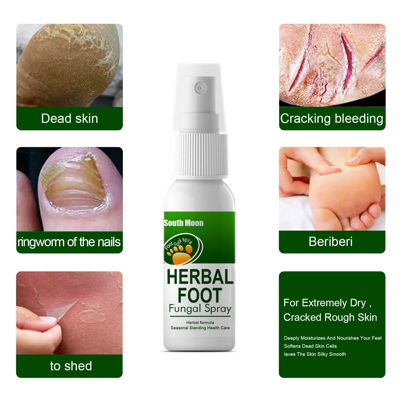 30ml foot care moisturising spray bottle for dry foot skin treatment