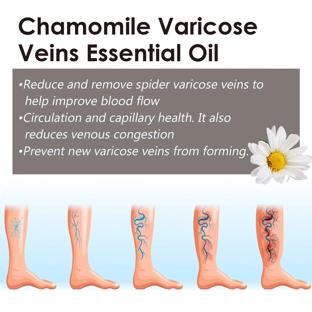 10ml chamomile essential oil bottle for leg care and discomfort relief massage