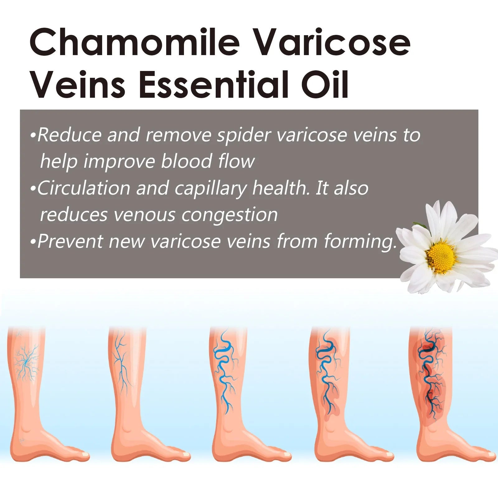 10ml chamomile essential oil bottle for leg care and discomfort relief massage