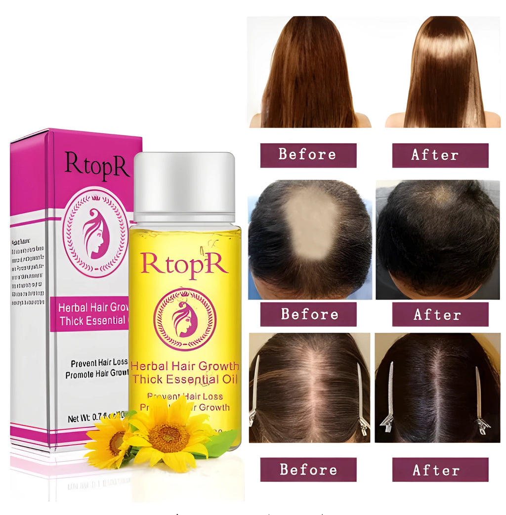 20ml hair growth essential oil liquid treatment in rose colour, for preventing hair loss and hair care