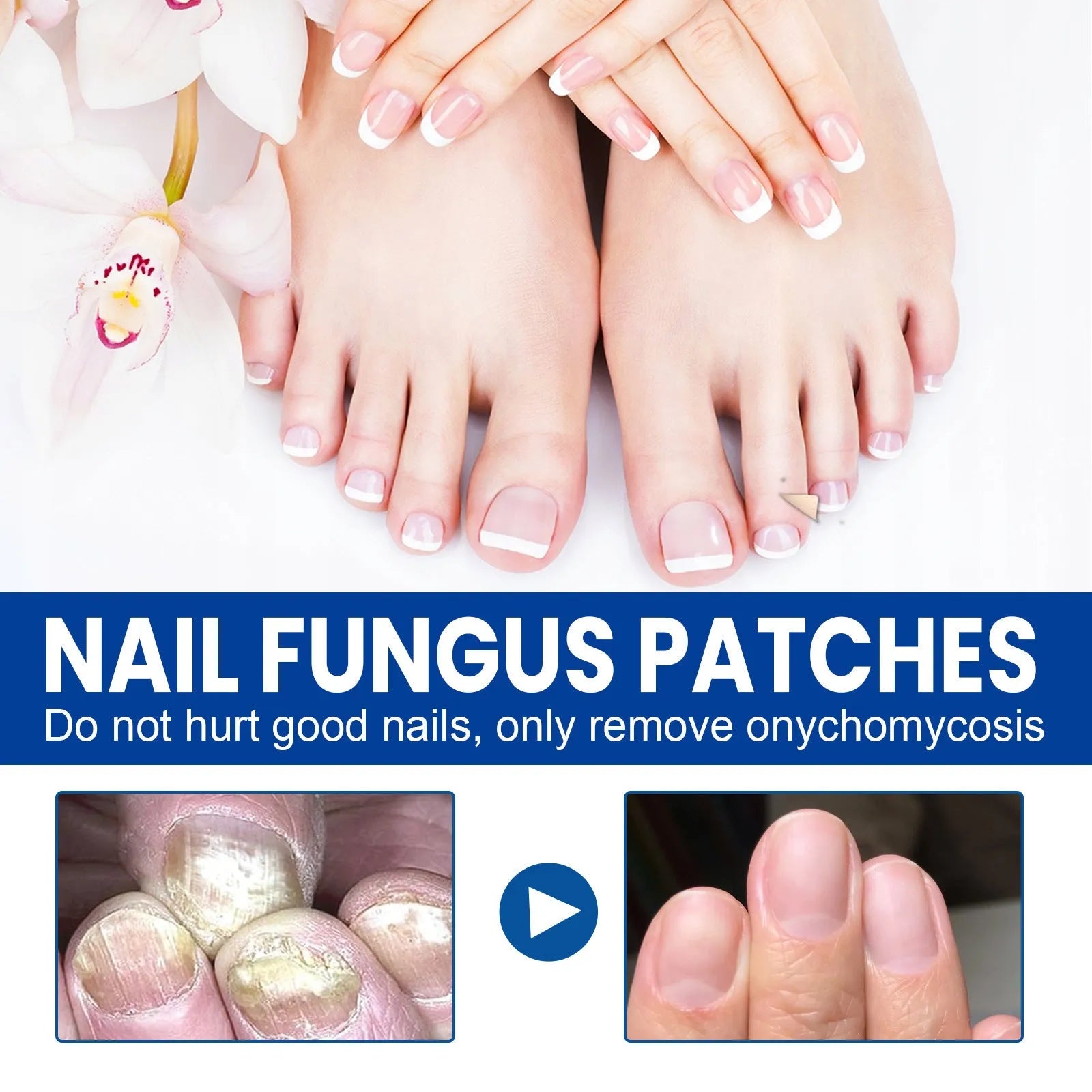 Box of 32 nail nursing adhesive bandage patches for repair, each patch 6.1 cm by 3.5 cm.