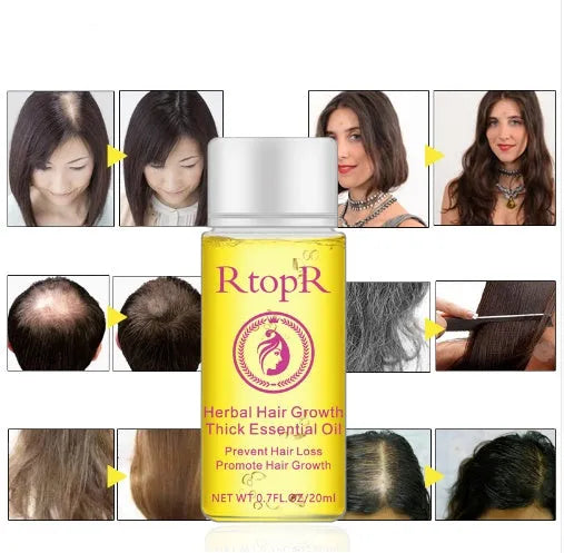 20ml hair growth essential oil liquid treatment in rose colour, for preventing hair loss and hair care