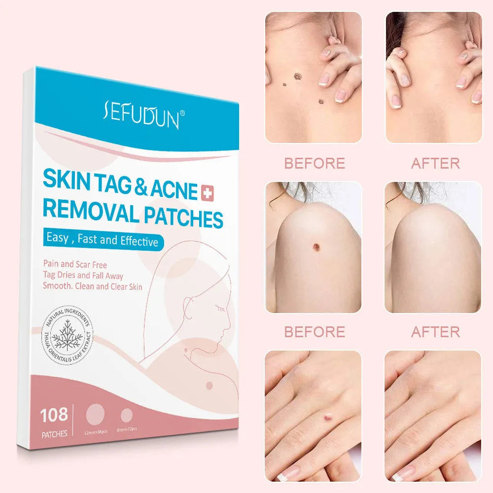 Acne skin tag remover patches 108 count white invisible wart removal stickers on face and body