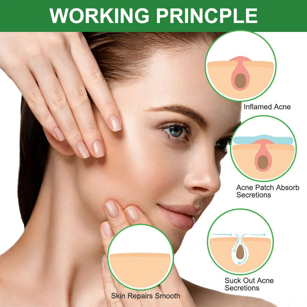 Colloidal invisible acne patch sheet green colour with 24 patches in 7mm, 10mm, 12mm sizes