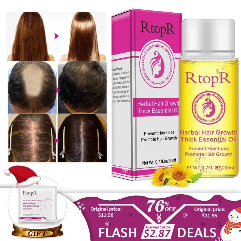 20ml hair growth essential oil liquid treatment in rose colour, for preventing hair loss and hair care