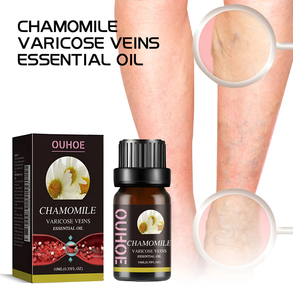 10ml chamomile essential oil bottle for leg care and discomfort relief massage