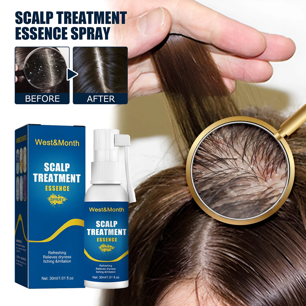 30ml Hair Root Care Spray in a bottle with a spray nozzle, designed for scalp itch relief and follicle nourishment.