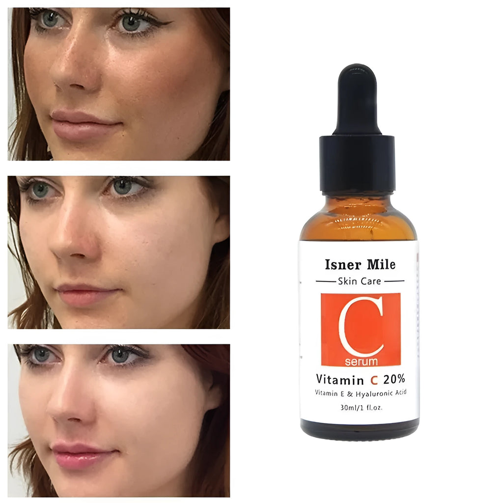 30ml liquid niacinamide hyaluronic acid serum in Red VC bottle with dropper