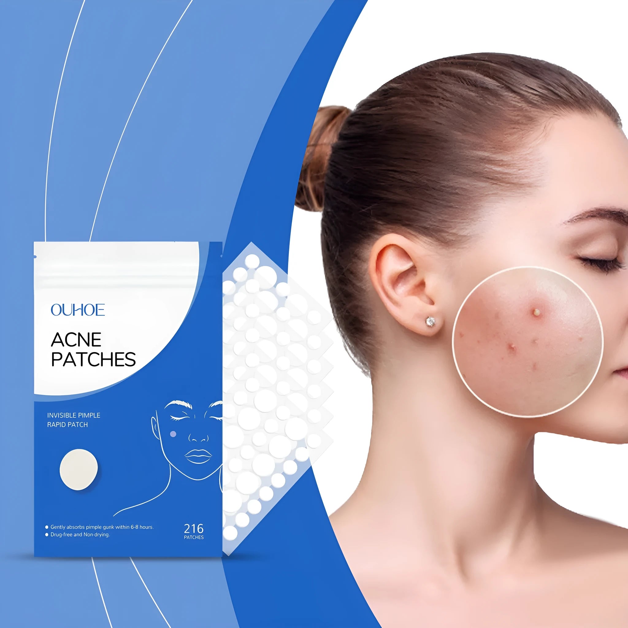 Acne patch sheet with 216 spots featuring Tea Tree Oil and Vitamin E for facial blemish care