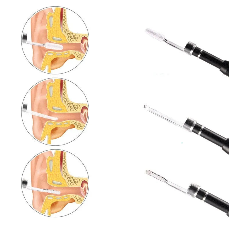 5.5mm three-in-one ear spoon visual ear endoscope with 1m cable and LED light