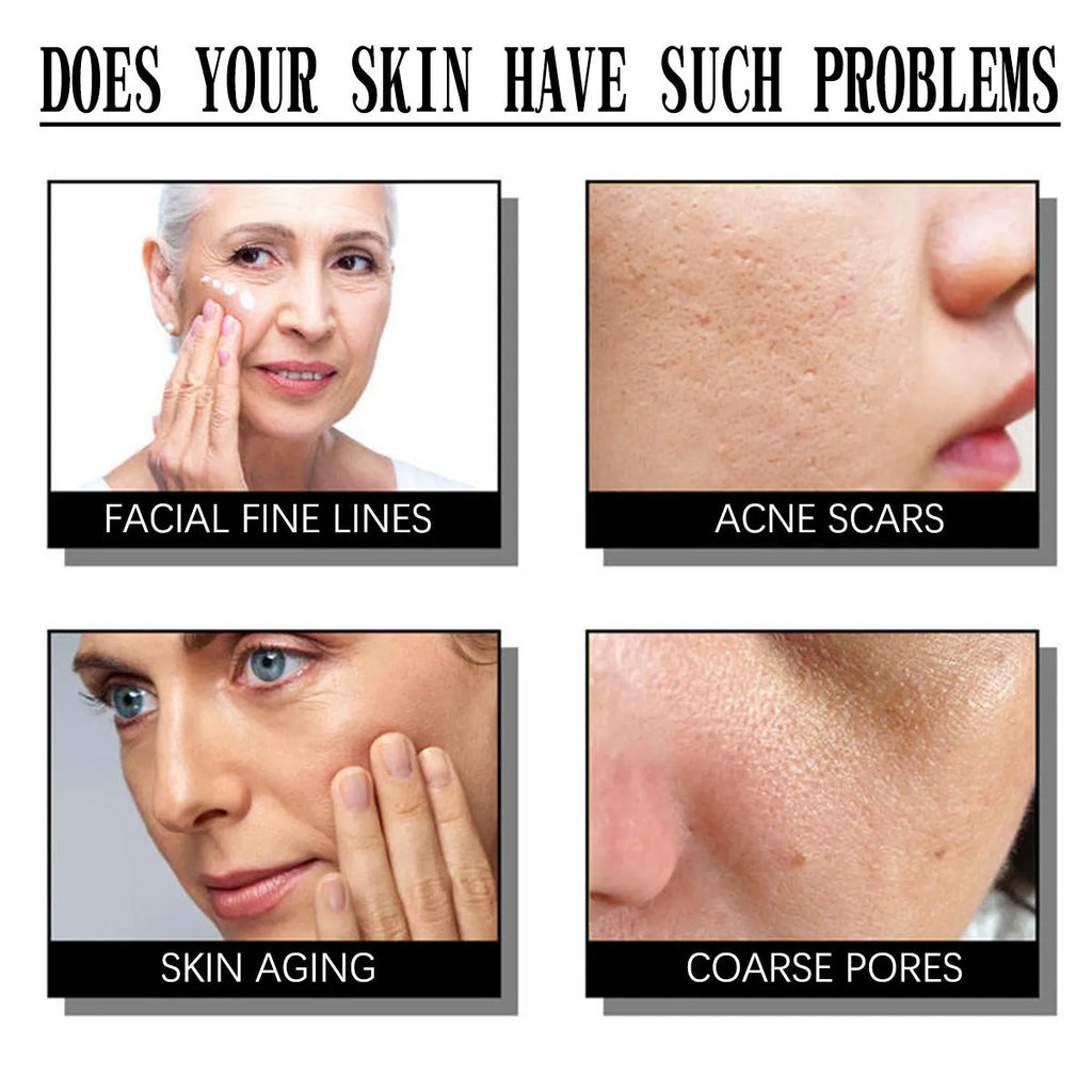 50g salicylate exfoliating moisturising cream for universal skin types