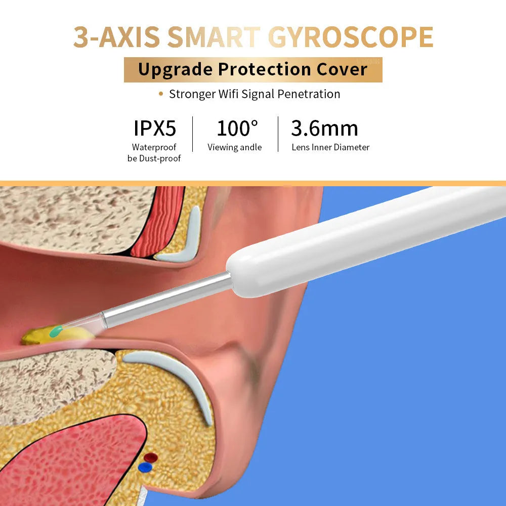 NE3 wireless otoscope ear cleaner with camera, LED light, and smartphone display showing ear canal view
