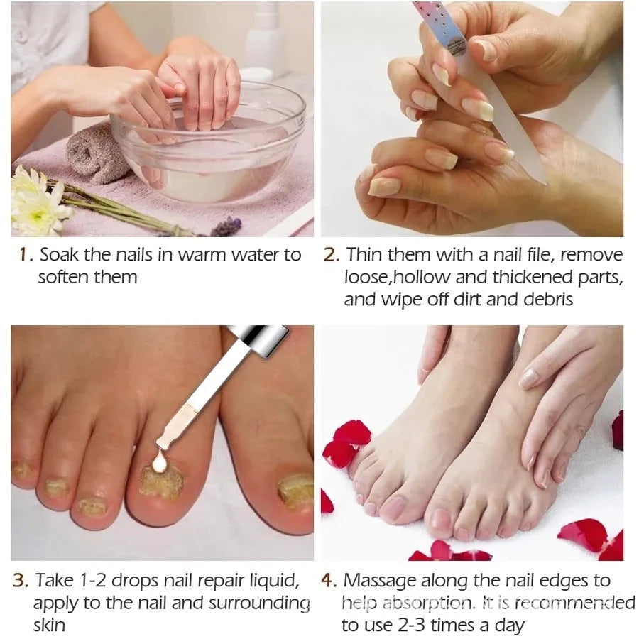 10ml whitenail antibacterial liquid bottle for foot care antimicrobial treatment