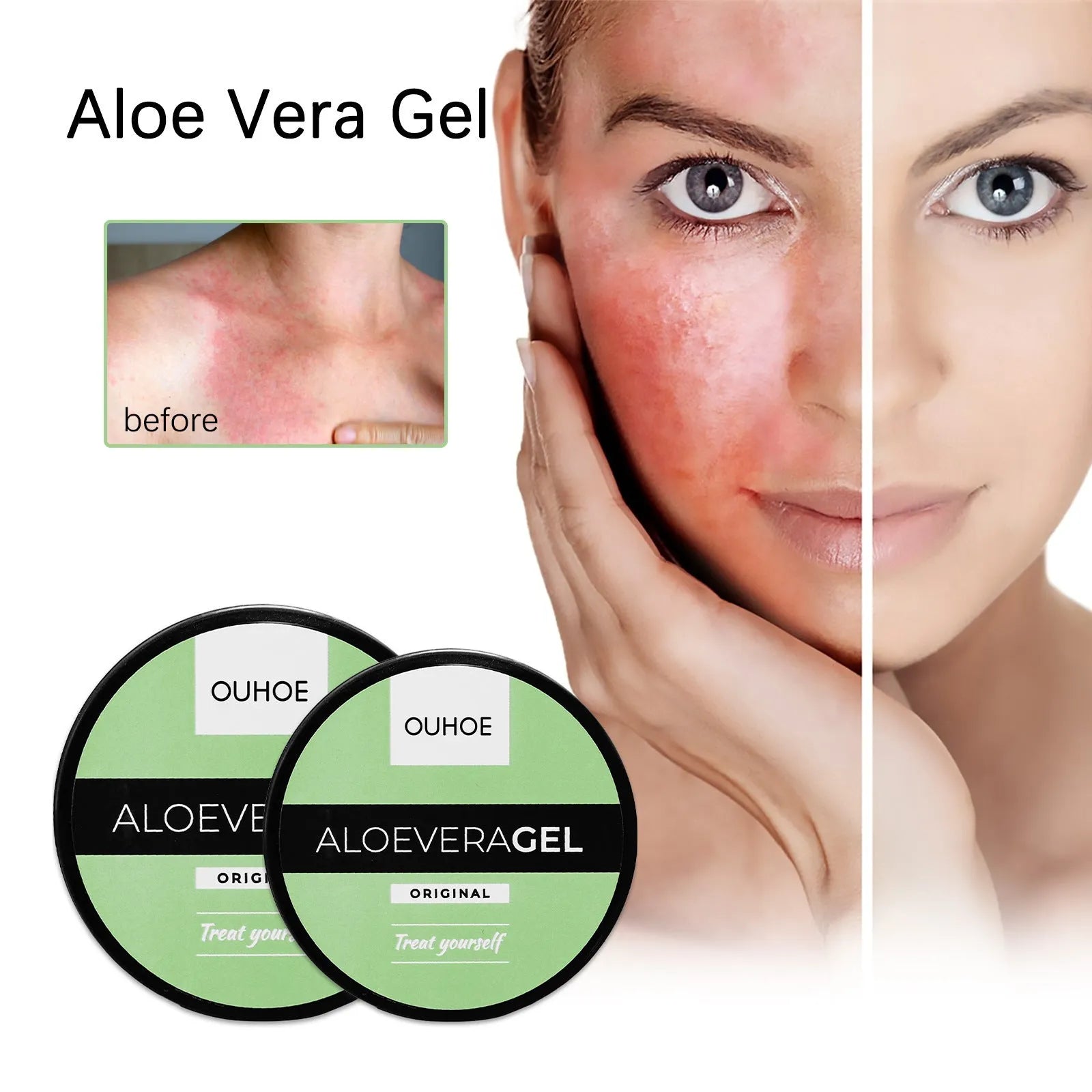 Tanning cream and aloe vera gel combo set for natural deep tan and after-sun repair, 50g and 100g sizes