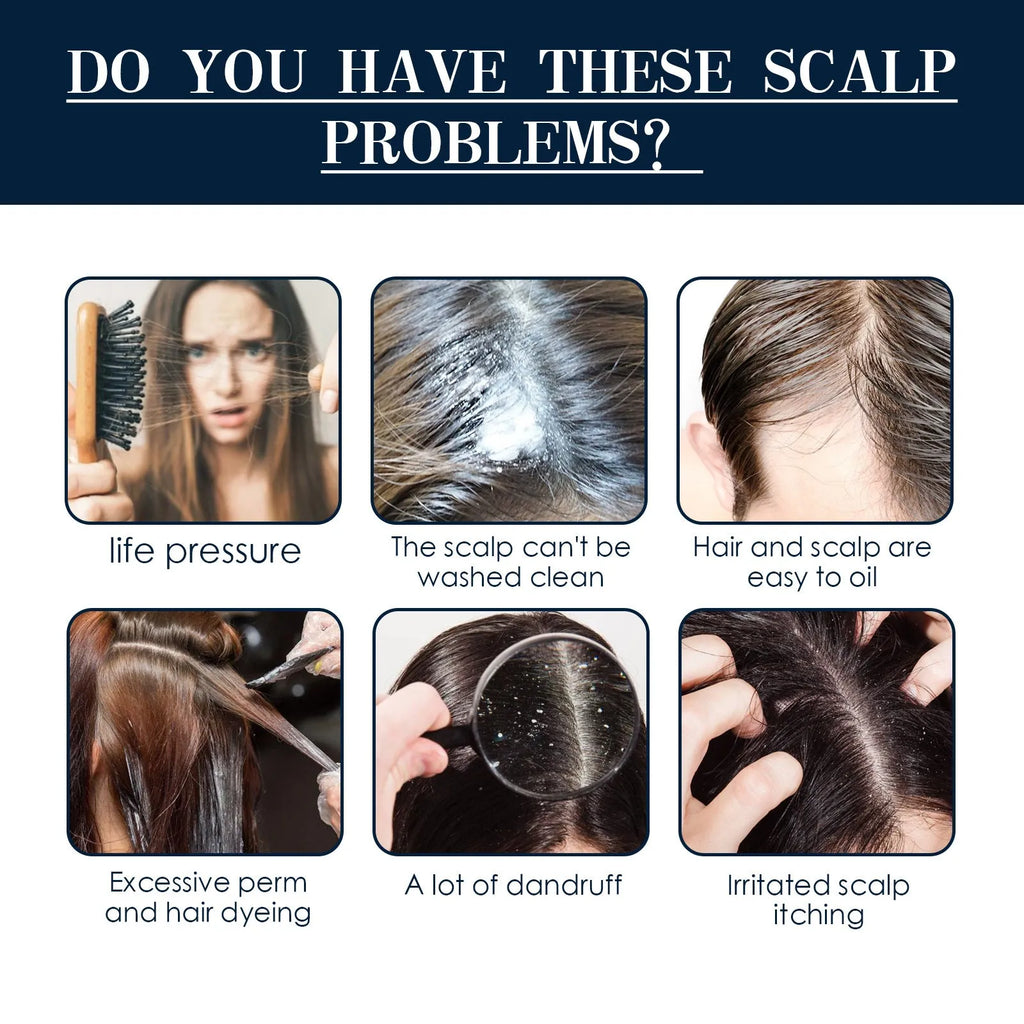 30ml Hair Root Care Spray in a bottle with a spray nozzle, designed for scalp itch relief and follicle nourishment.