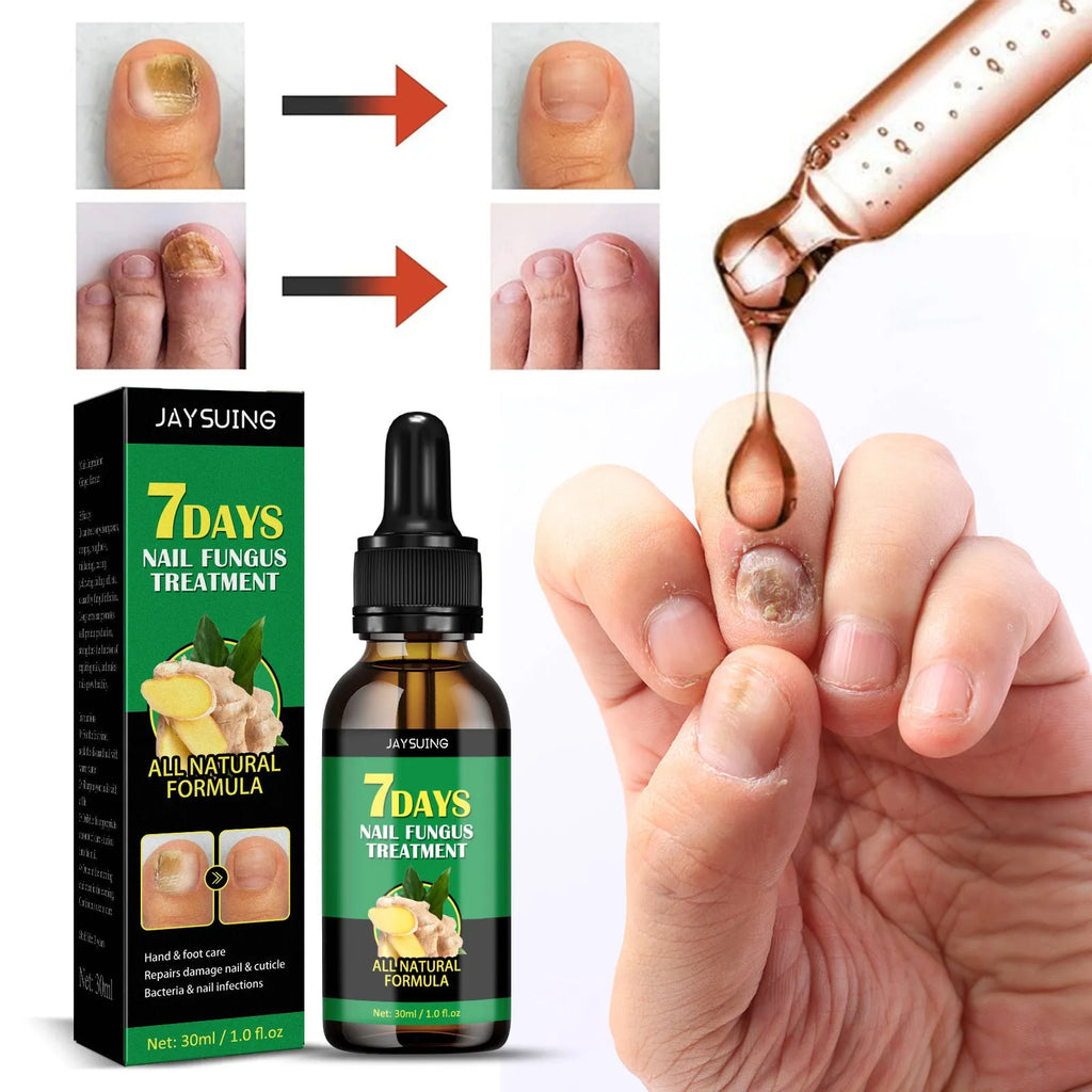 Ginger nail care lotion 30ml bottle with nail sticker box for hand and foot moisturising