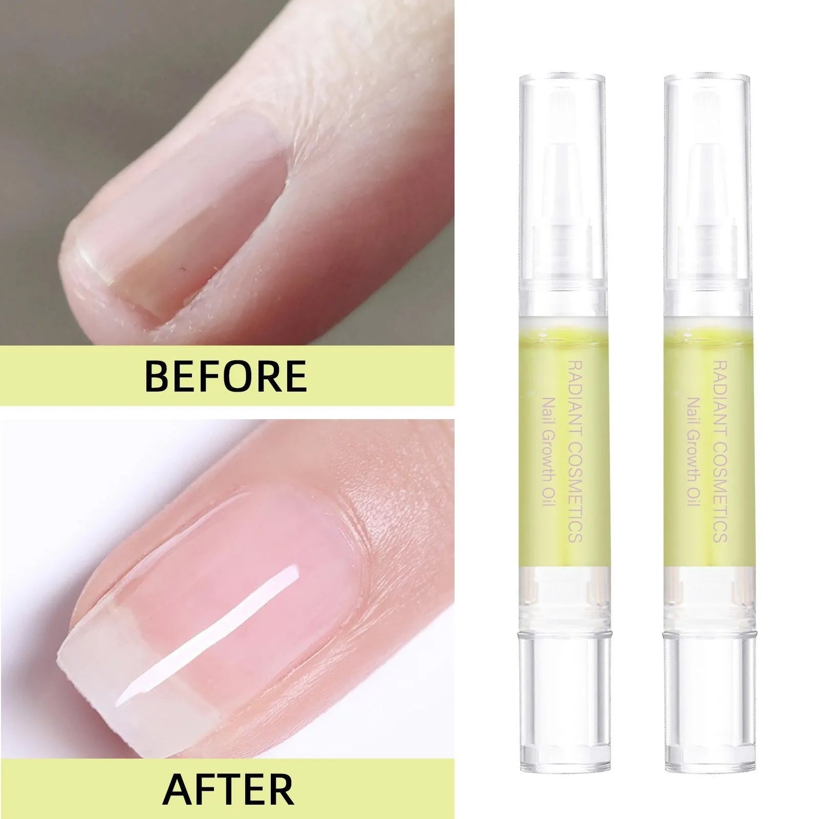 3ml bottle of wash-free nail growth and moisturising treatment oil for cuticle care.