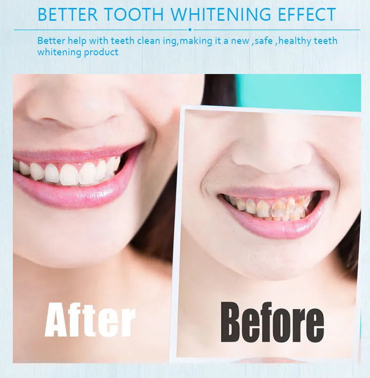 Teeth whitening pen with gel in aluminium case, multiple colour options, for adult use