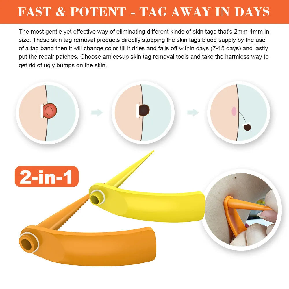 Orange yellow wart removal tool kit with rubber rings, removal devices and medical accessories