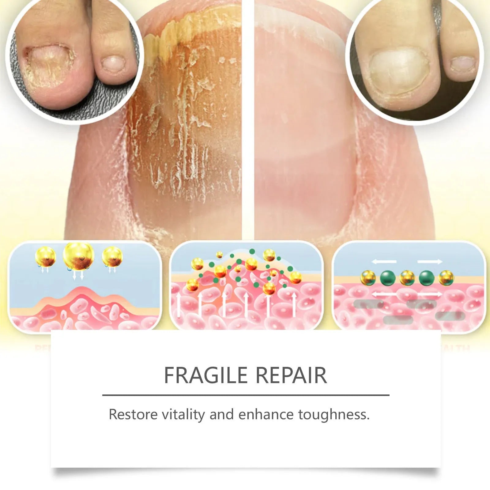 50ml bottle of nail care solution with bee venom and peppermint oil for fungal nail treatment