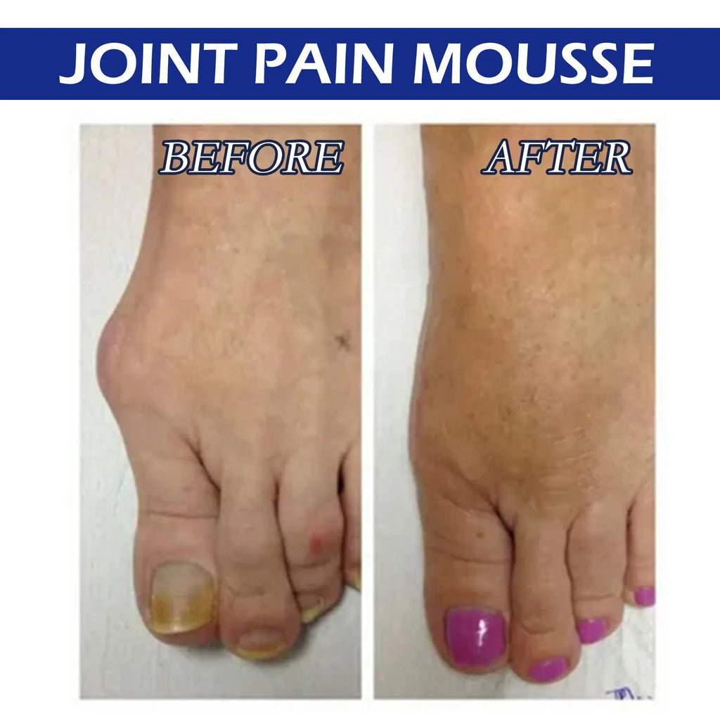 15ml bottle of herbal body care solution for joint massage and muscle relief