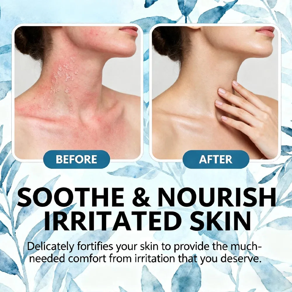 100ml seborrheic dermatitis cream for flaky dry scalp, itchy skin, and eczema on face, body, and scalp