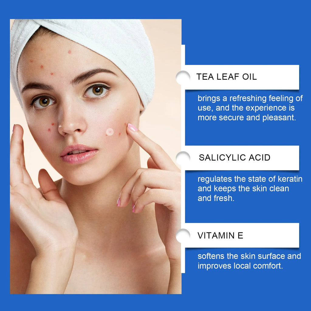 Acne patch sheet with 216 spots featuring Tea Tree Oil and Vitamin E for facial blemish care