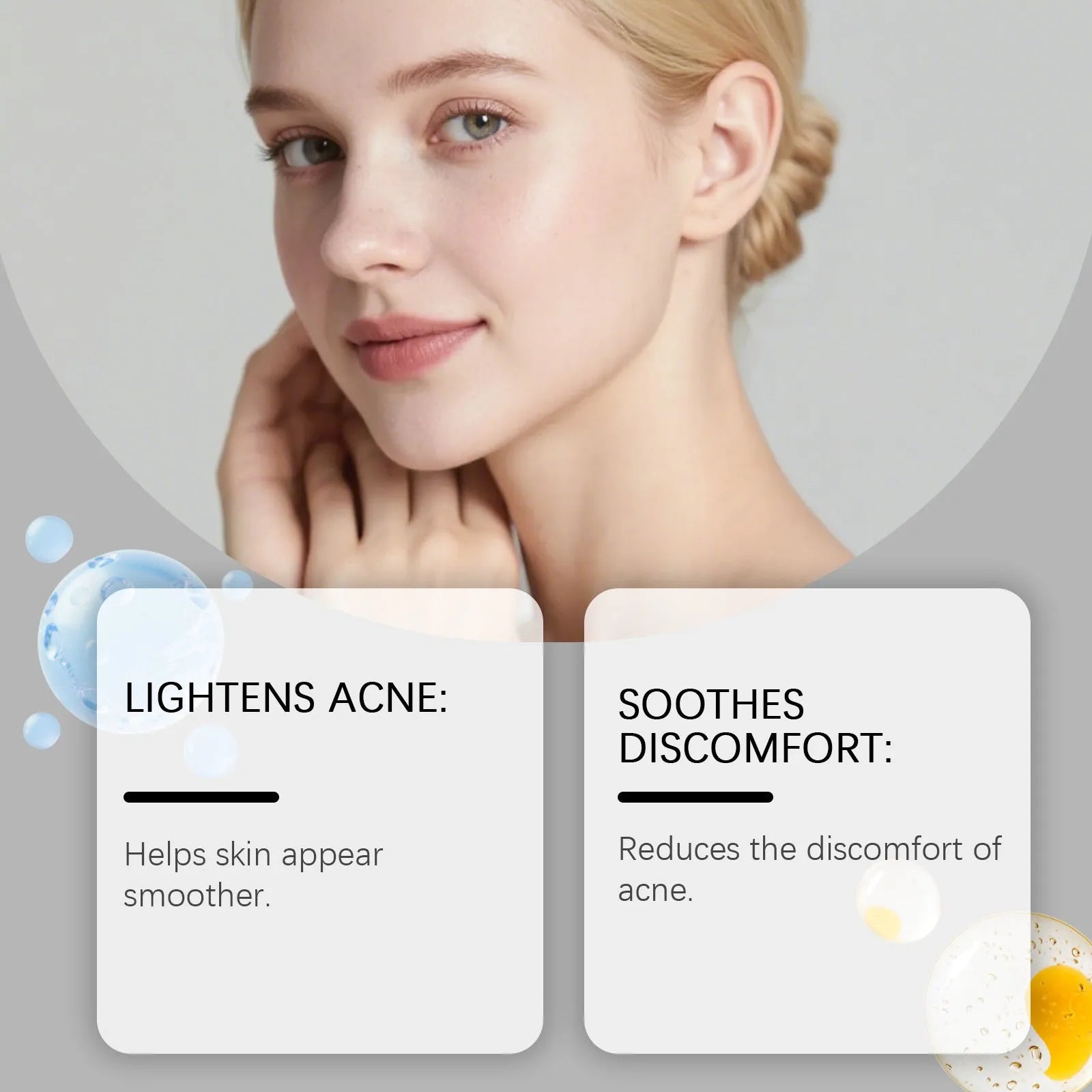 Pack of 80 breathable facial acne patches for daily skincare use