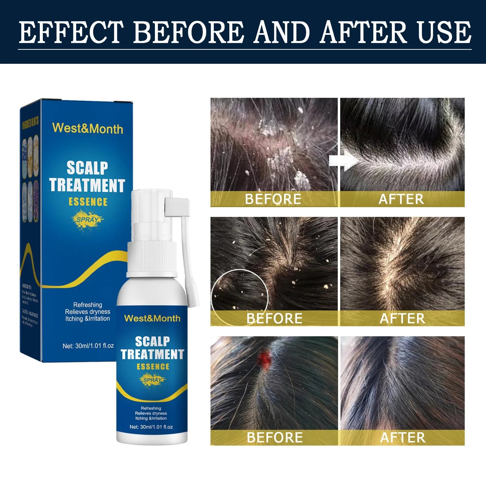 30ml Hair Root Care Spray in a bottle with a spray nozzle, designed for scalp itch relief and follicle nourishment.