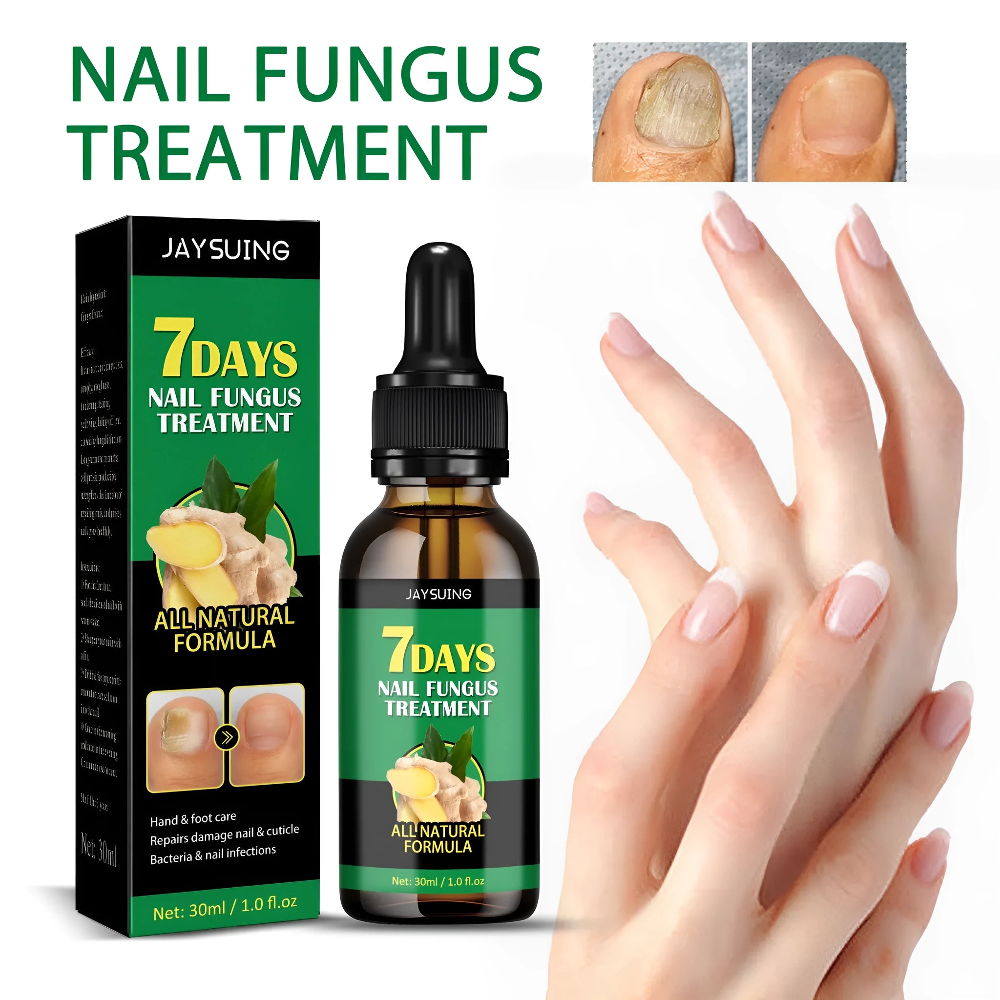 Ginger nail care lotion 30ml bottle with nail sticker box for hand and foot moisturising