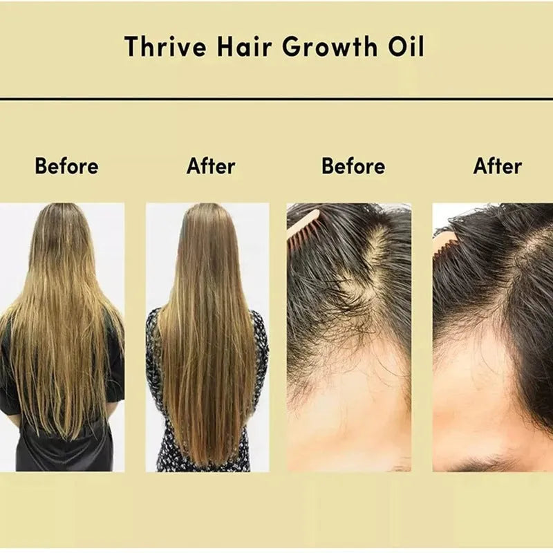 60ml bottle of yellow rosemary essential oil for hair care and scalp treatment