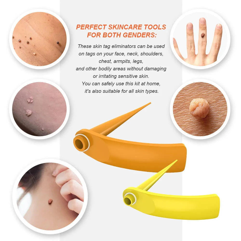 Orange yellow wart removal tool kit with rubber rings, removal devices and medical accessories