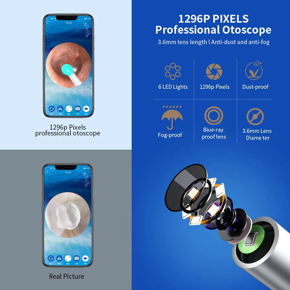 NE3 wireless otoscope ear cleaner with camera, LED light, and smartphone display showing ear canal view
